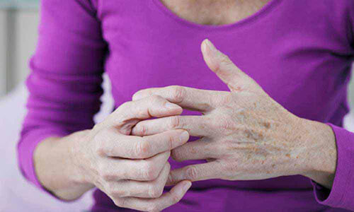 How to Live with Rheumatoid Arthritis